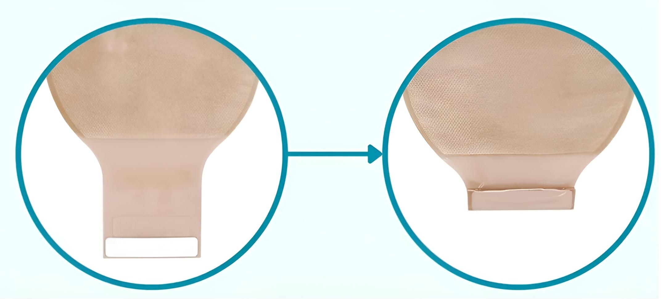 کیسه استومی دوتیکه ته باز