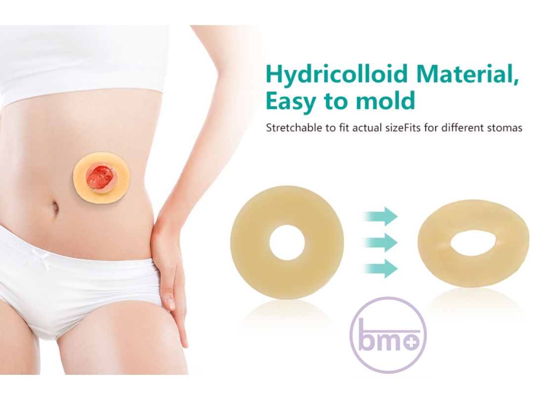 حلقه‌ی محافظ استومی انگلیسی