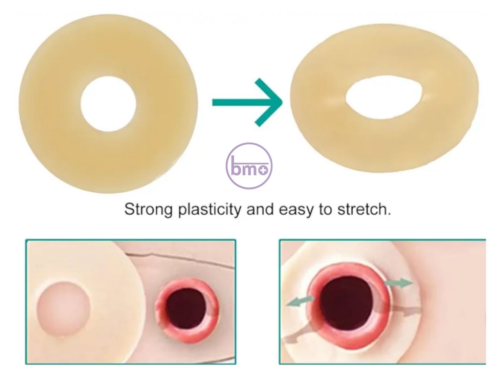 حلقه‌ی محافظ استومی انگلیسی