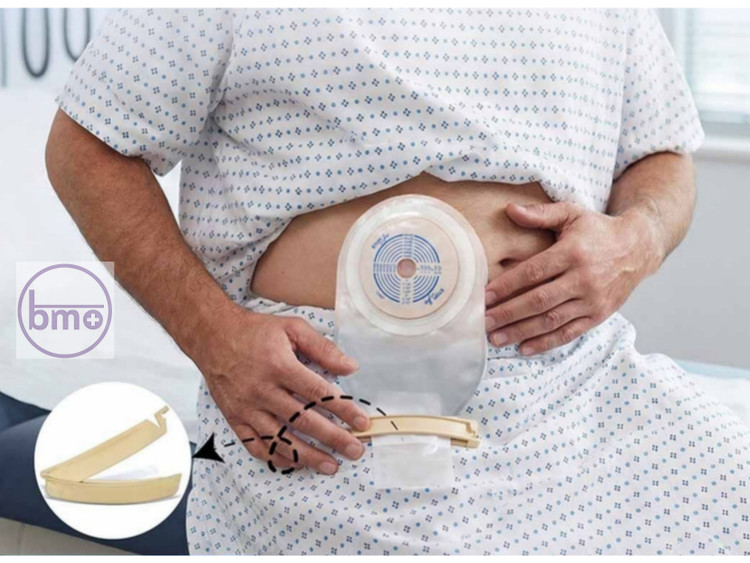 کیسه کلستومی و ایلئوستومی یکتکه تهباز مات کانوآتک ConvaTec Active Life کد 22773؛ سایز استاندارد ۱۹ تا ۶۴ میلیمتر