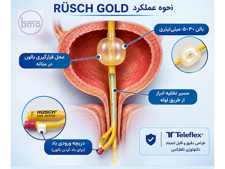 سوند فولی دو راهه روش گلد سایز ۱۸ تلفلکس (RÜSCH GOLD Ch. 18 / 6.0mm) بالون ۳۰ تا ۵۰ میلیلیتر